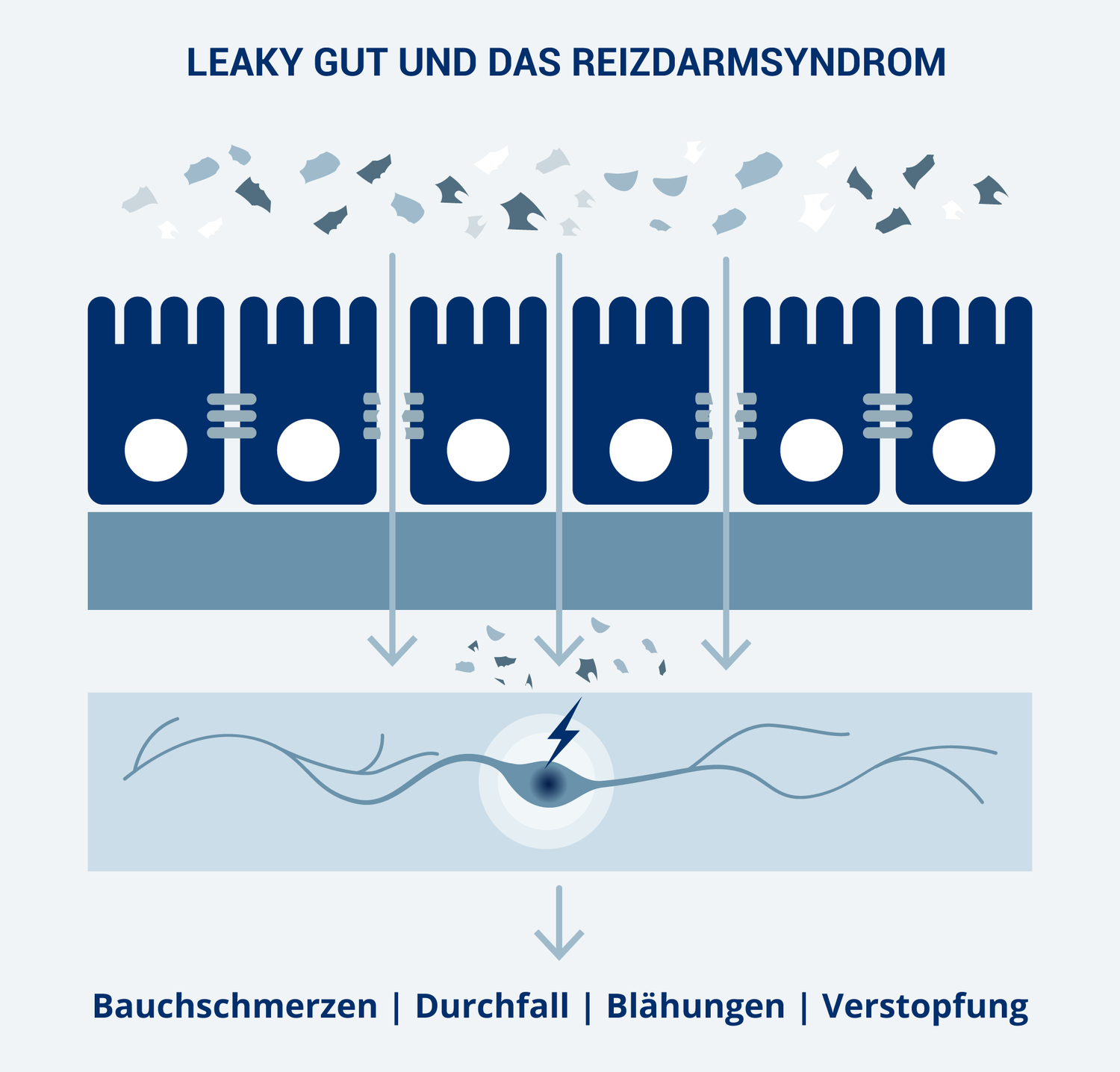 Leaky Gut und Reizdarmsyndrom